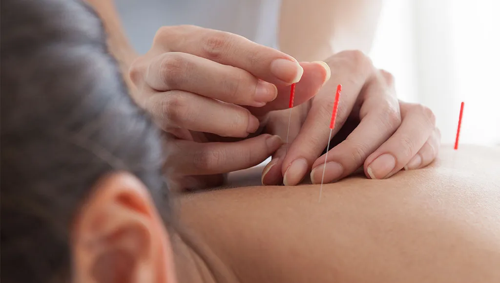 Medicina China Tradicional