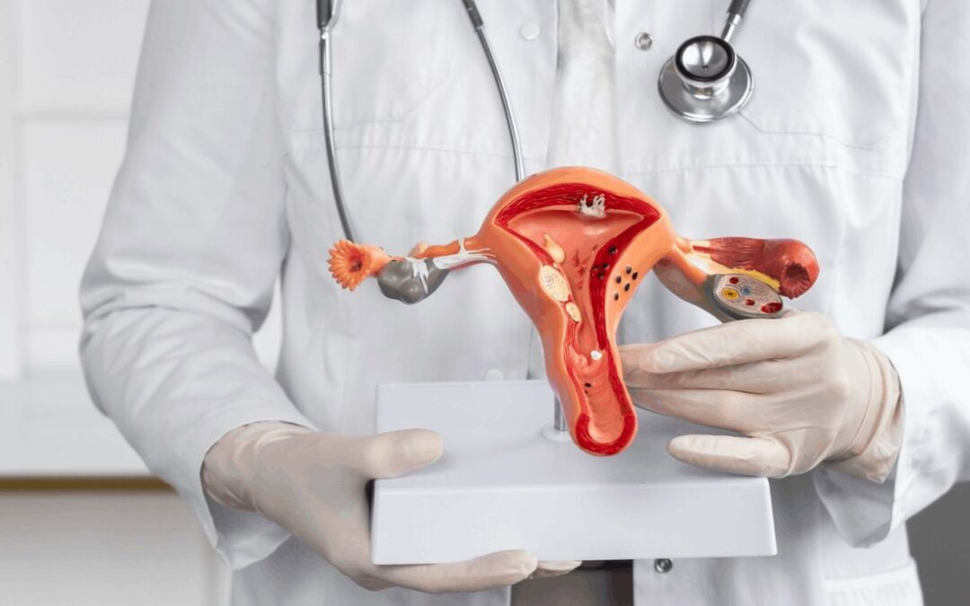 Miomas uterinos: causas, síntomas y tratamientos