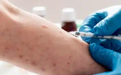 Virus del Papiloma Humano (VPH): conocimientos esenciales para la prevención y manejo